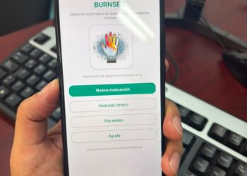 Estudiante de FING-UACH desarrolla app para detectar quemaduras de piel con el celular.